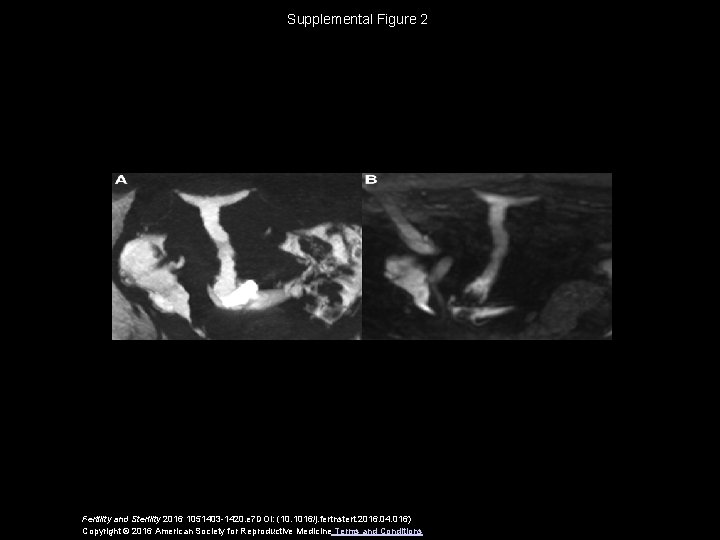 Supplemental Figure 2 Fertility and Sterility 2016 1051403 -1420. e 7 DOI: (10. 1016/j.