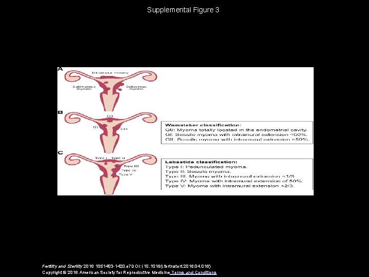 Supplemental Figure 3 Fertility and Sterility 2016 1051403 -1420. e 7 DOI: (10. 1016/j.