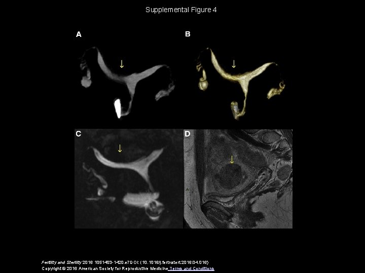 Supplemental Figure 4 Fertility and Sterility 2016 1051403 -1420. e 7 DOI: (10. 1016/j.