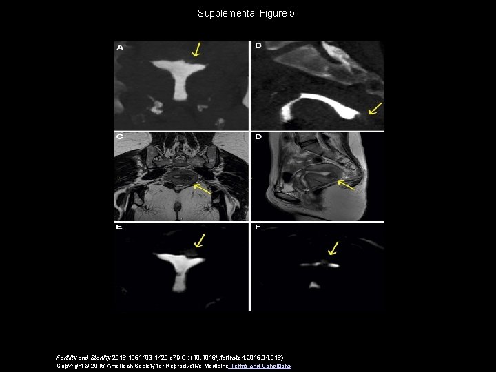 Supplemental Figure 5 Fertility and Sterility 2016 1051403 -1420. e 7 DOI: (10. 1016/j.