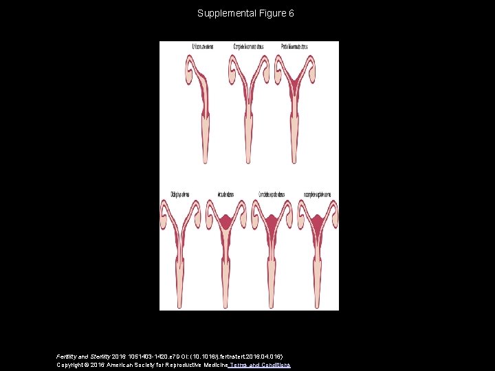 Supplemental Figure 6 Fertility and Sterility 2016 1051403 -1420. e 7 DOI: (10. 1016/j.