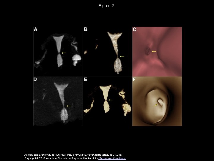 Figure 2 Fertility and Sterility 2016 1051403 -1420. e 7 DOI: (10. 1016/j. fertnstert.