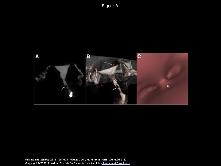 Figure 3 Fertility and Sterility 2016 1051403 -1420. e 7 DOI: (10. 1016/j. fertnstert.