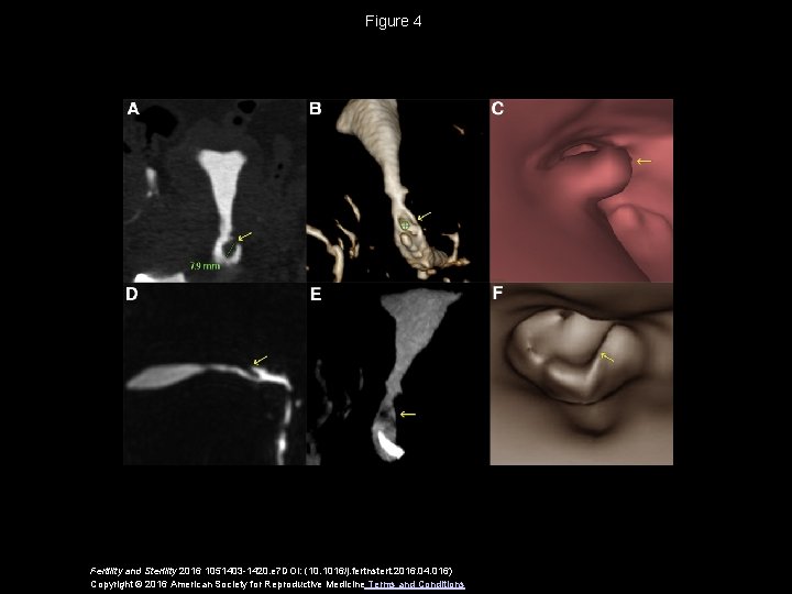 Figure 4 Fertility and Sterility 2016 1051403 -1420. e 7 DOI: (10. 1016/j. fertnstert.