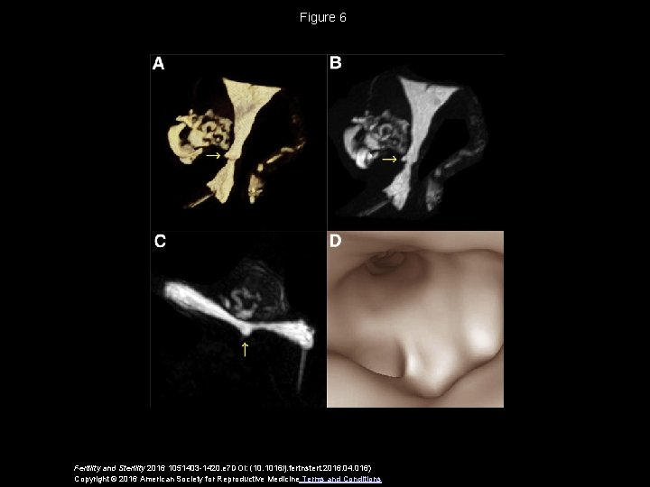 Figure 6 Fertility and Sterility 2016 1051403 -1420. e 7 DOI: (10. 1016/j. fertnstert.
