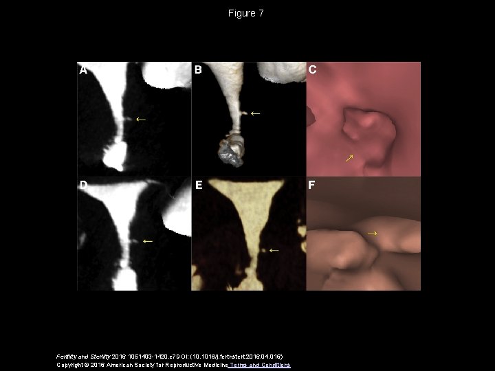 Figure 7 Fertility and Sterility 2016 1051403 -1420. e 7 DOI: (10. 1016/j. fertnstert.