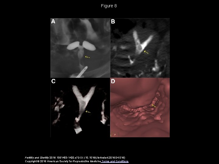 Figure 8 Fertility and Sterility 2016 1051403 -1420. e 7 DOI: (10. 1016/j. fertnstert.