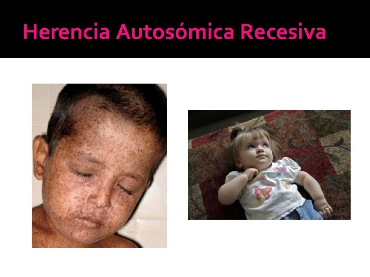 Herencia Autosómica Recesiva Herencia Autosómica Recesiva
