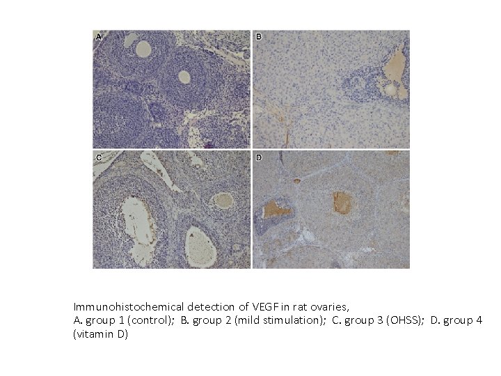 Immunohistochemical detection of VEGF in rat ovaries, A. group 1 (control); B. group 2