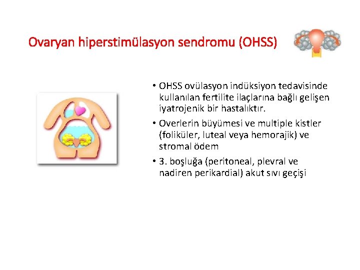 Ovaryan hiperstimülasyon sendromu (OHSS) • OHSS ovülasyon indüksiyon tedavisinde kullanılan fertilite ilaçlarına bağlı gelişen