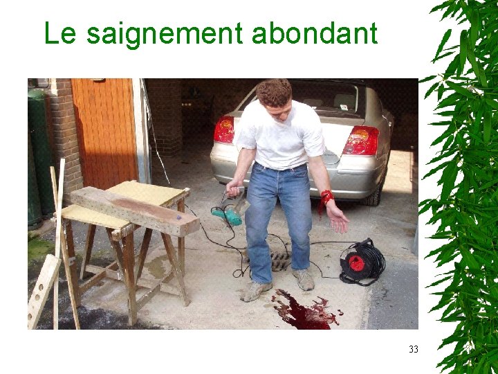 Le saignement abondant 33 