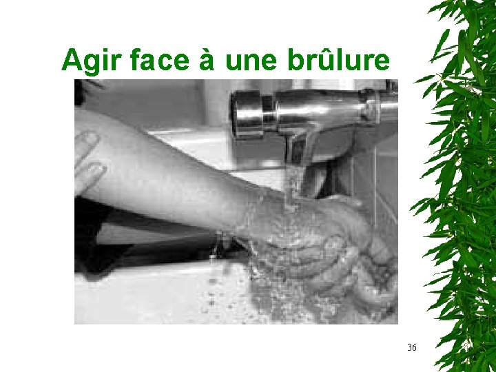 Agir face à une brûlure 36 