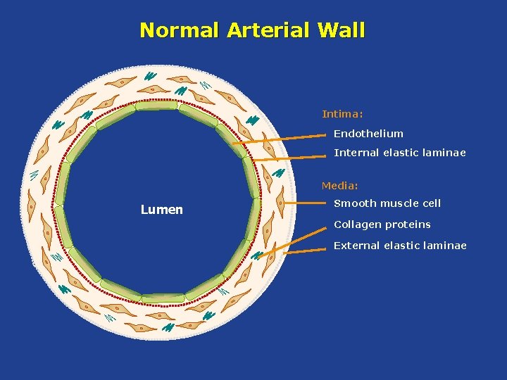 Normal Arterial Wall Intima: Endothelium Internal elastic laminae Media: Lumen Smooth muscle cell Collagen