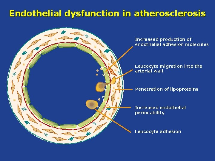 Endothelial dysfunction in atherosclerosis Increased production of endothelial adhesion molecules Leucocyte migration into the