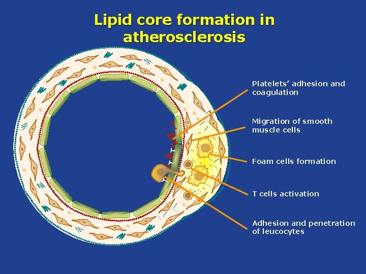 Lipid core formation in atherosclerosis Platelets’ adhesion and coagulation Migration of smooth muscle cells