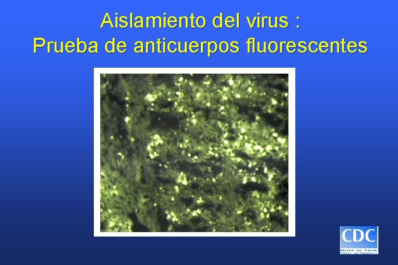 Aislamiento del virus : Prueba de anticuerpos fluorescentes 