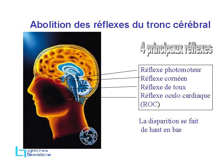 Abolition des réflexes du tronc cérébral Réflexe photomoteur Réflexe cornéen Réflexe de toux Réflexe