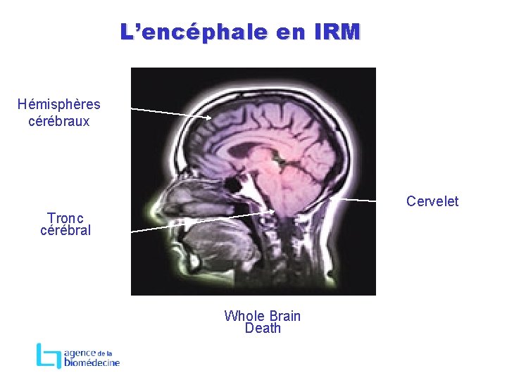 L’encéphale en IRM Hémisphères cérébraux Cervelet Tronc cérébral Whole Brain Death 