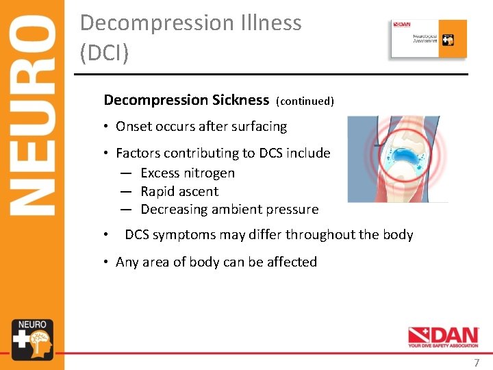 Decompression Illness (DCI) Decompression Sickness (continued) • Onset occurs after surfacing • Factors contributing Decompression Illness (DCI) Decompression Sickness (continued) • Onset occurs after surfacing • Factors contributing