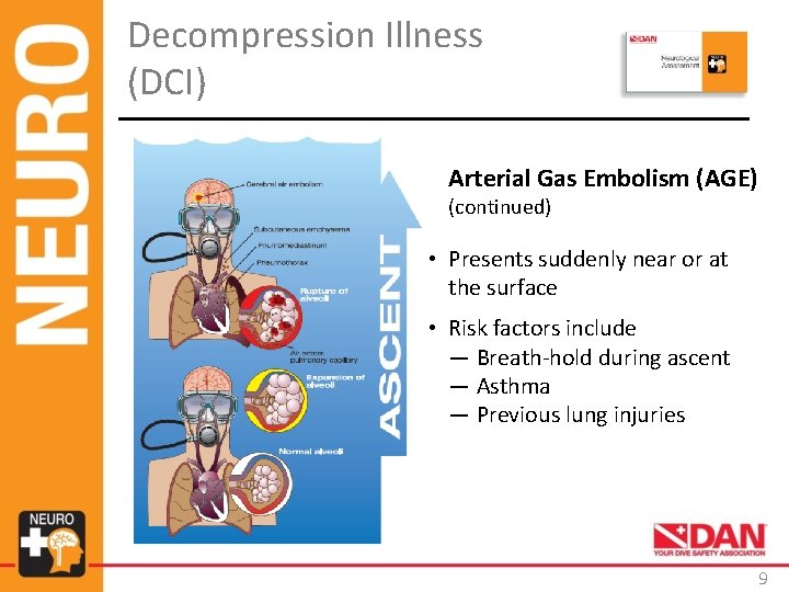 Decompression Illness (DCI) Arterial Gas Embolism (AGE) (continued) • Presents suddenly near or at Decompression Illness (DCI) Arterial Gas Embolism (AGE) (continued) • Presents suddenly near or at