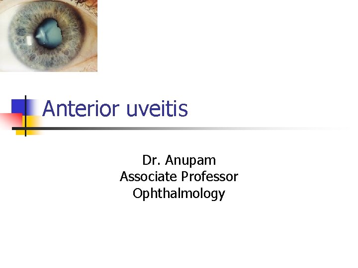 Anterior uveitis Dr. Anupam Associate Professor Ophthalmology Anterior uveitis Dr. Anupam Associate Professor Ophthalmology