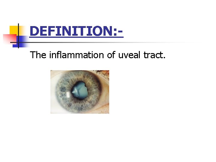 DEFINITION: The inflammation of uveal tract. DEFINITION: The inflammation of uveal tract.
