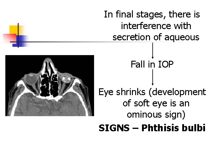 In final stages, there is interference with secretion of aqueous Fall in IOP Eye In final stages, there is interference with secretion of aqueous Fall in IOP Eye