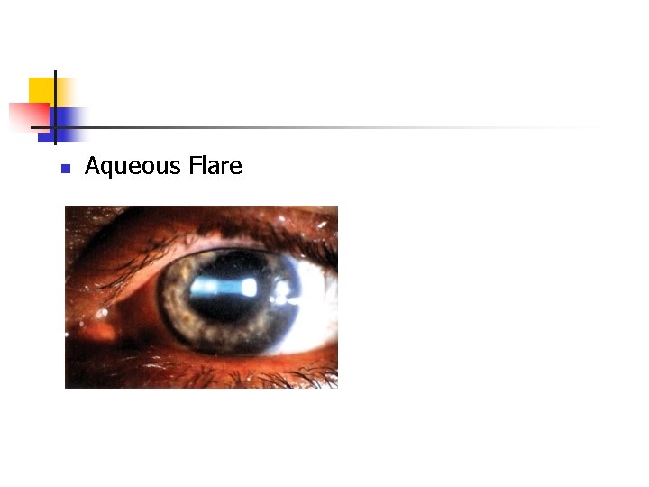 n Aqueous Flare n Aqueous Flare