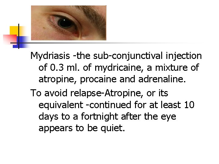 Mydriasis -the sub-conjunctival injection of 0. 3 ml. of mydricaine, a mixture of atropine, Mydriasis -the sub-conjunctival injection of 0. 3 ml. of mydricaine, a mixture of atropine,