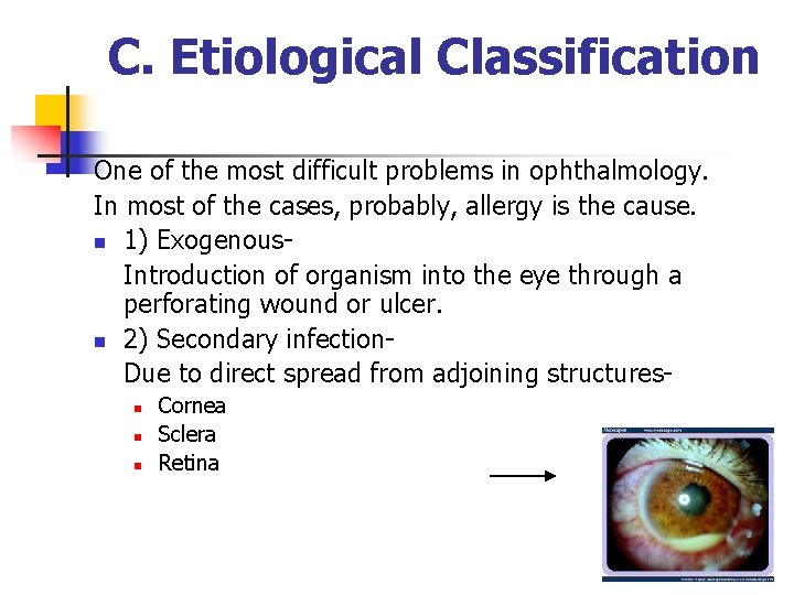 C. Etiological Classification One of the most difficult problems in ophthalmology. In most of C. Etiological Classification One of the most difficult problems in ophthalmology. In most of