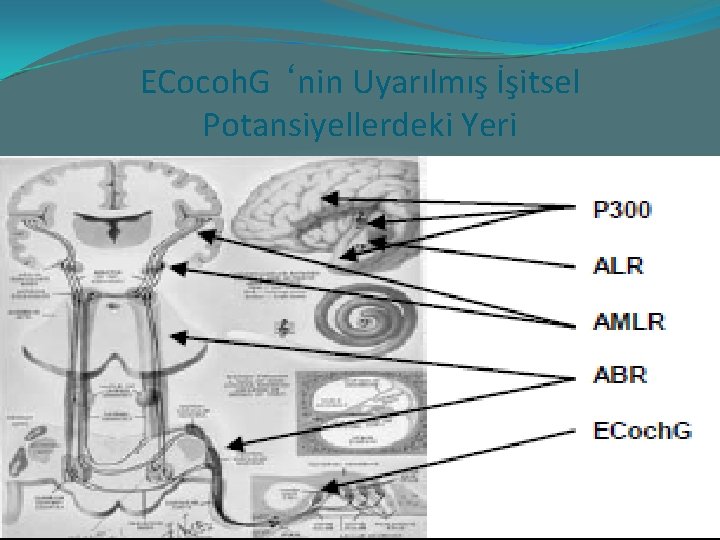 ECocoh. G ‘nin Uyarılmış İşitsel Potansiyellerdeki Yeri 