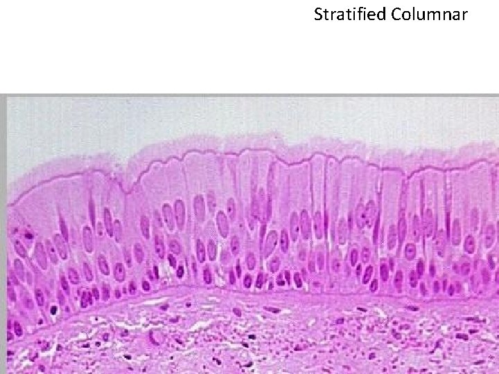 Stratified Columnar 