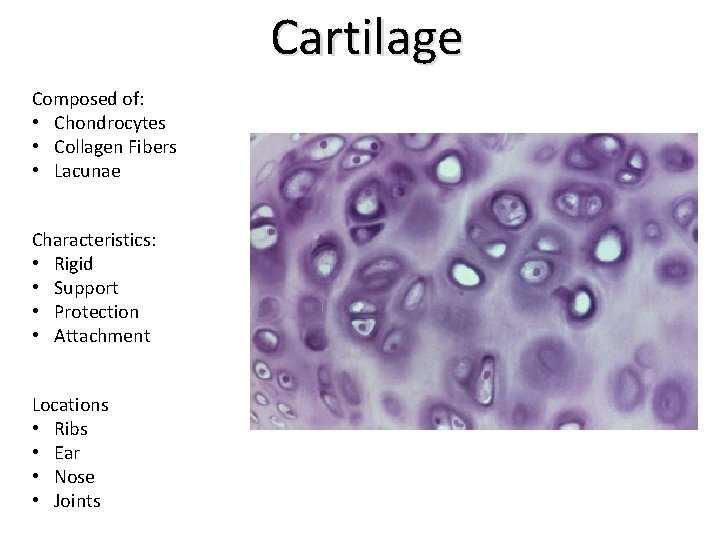 Cartilage Composed of: • Chondrocytes • Collagen Fibers • Lacunae Characteristics: • Rigid •