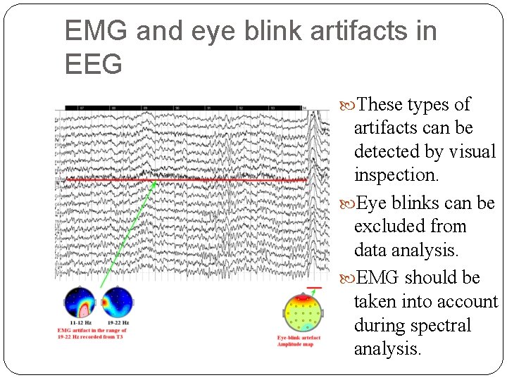 EMG and eye blink artifacts in EEG These types of artifacts can be detected