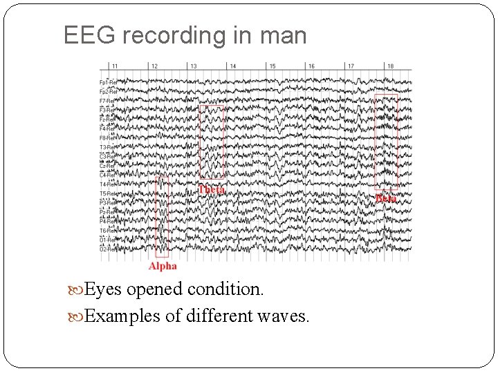 EEG recording in man Eyes opened condition. Examples of different waves. 