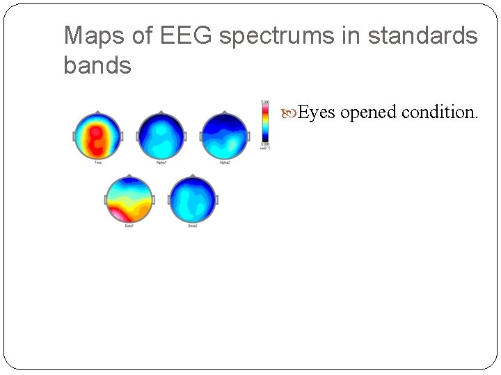 Maps of EEG spectrums in standards bands Eyes opened condition. 
