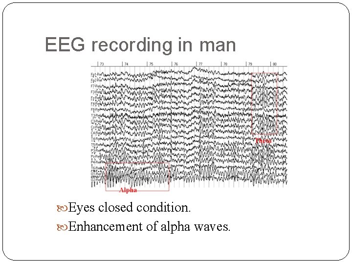 EEG recording in man Eyes closed condition. Enhancement of alpha waves. 