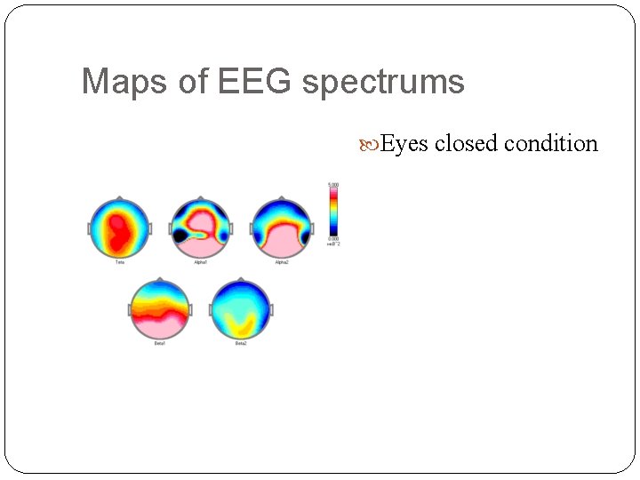 Maps of EEG spectrums Eyes closed condition 