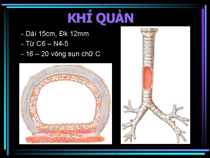 KHÍ QUẢN - Dài 15 cm, Đk 12 mm - Từ C 6 –