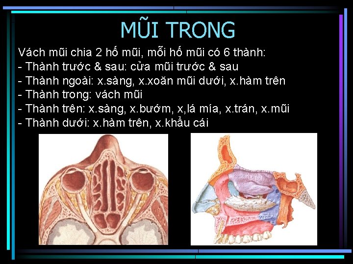 MŨI TRONG Vách mũi chia 2 hố mũi, mỗi hố mũi có 6 thành: