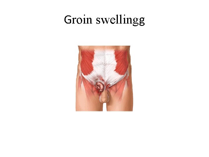 Groin swellingg 