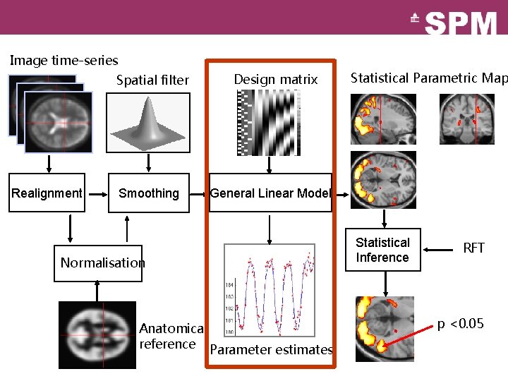 Image time-series Spatial filter Realignment Smoothing Design matrix Statistical Parametric Map General Linear Model