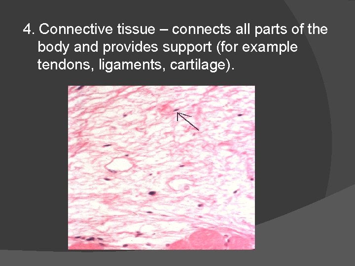 4. Connective tissue – connects all parts of the body and provides support (for
