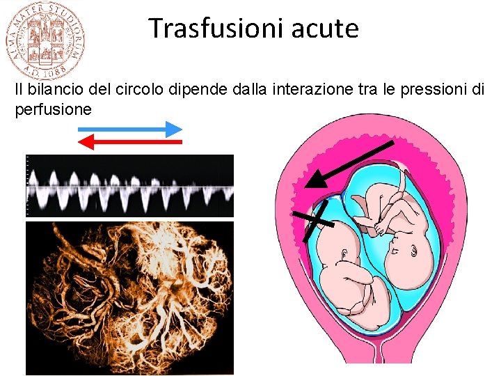 Trasfusioni acute Il bilancio del circolo dipende dalla interazione tra le pressioni di perfusione Trasfusioni acute Il bilancio del circolo dipende dalla interazione tra le pressioni di perfusione
