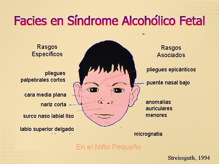 Facies en Síndrome Alcohólico Fetal Rasgos Específicos Rasgos Asociados pliegues epicánticos pliegues palpebrales cortos