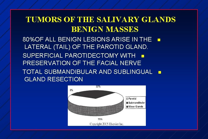 TUMORS OF THE SALIVARY GLANDS BENIGN MASSES 80%OF ALL BENIGN LESIONS ARISE IN THE