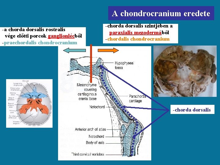 A chondrocranium eredete -a chorda dorsalis rostralis vége előtti porcok ganglionlécből -praechordalis chondrocranium -chorda