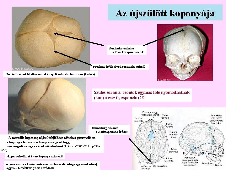 Az újszülött koponyája fonticulus anterior -a 2. év közepén záródik -rugalmas kötőszöveti varratok: suturák