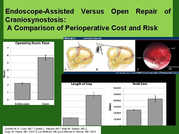 Endoscope-Assisted Versus Open Repair of Craniosynostosis: A Comparison of Perioperative Cost and Risk Jennifer