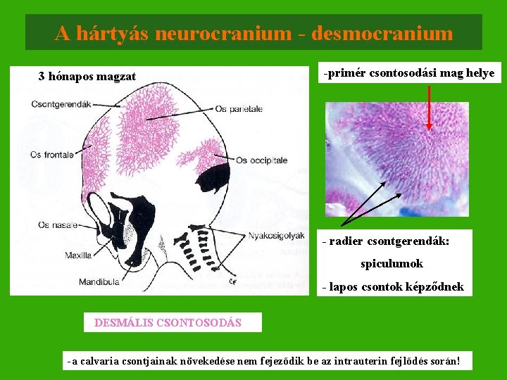 A hártyás neurocranium - desmocranium 3 hónapos magzat -primér csontosodási mag helye - radier